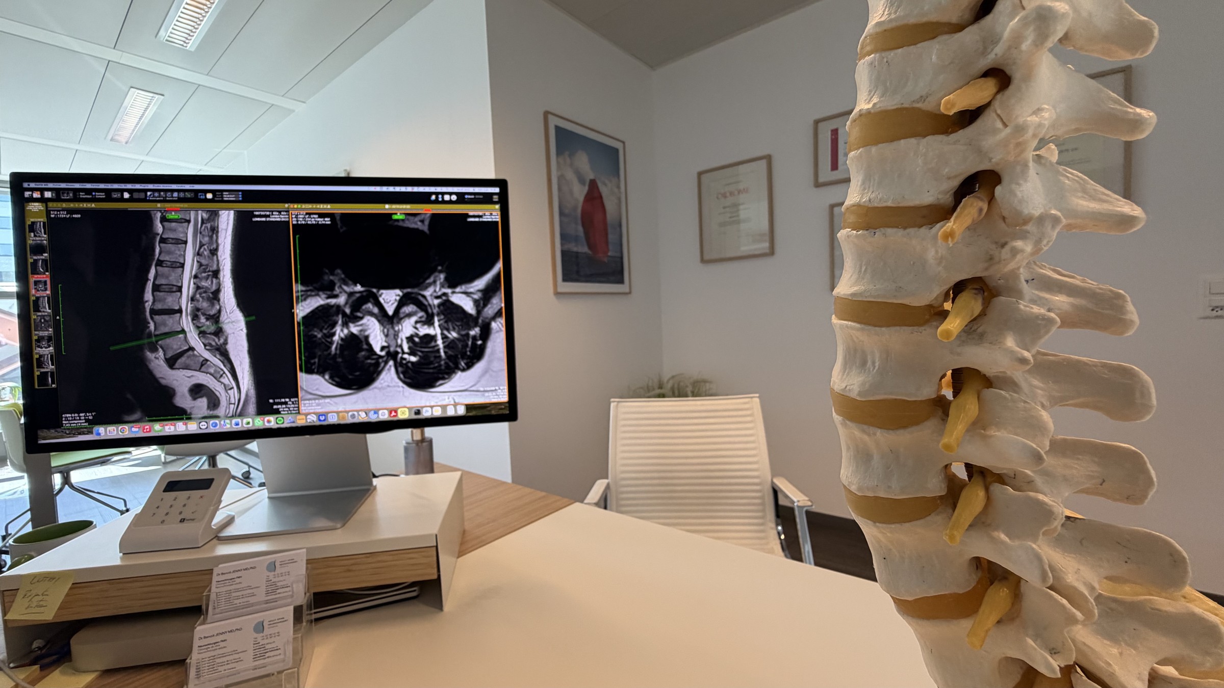 Spine model and MRI imaging at the practice